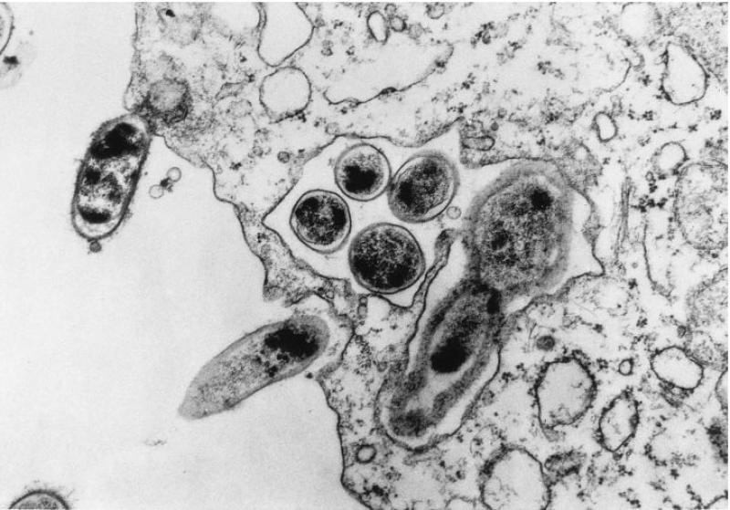 Электронная микрофотография B. henselae, связанных с клетками HEP-2. Несколько внутриклеточных бактерий можно увидеть внутри одной вакуоли. За пределами клетки также можно увидеть бактерий. Batterman, H. J., J. A. Peek, J. S. Loutit, S. Falkow, and L. S. Tompkins. 1995. Bartonella henselae and Bartonella quintana adherence to and entry into cultured human epithelial cells. Infect. Immun. 63:4553–4556 | Болезнь кошачьей царапины Электронная микрофотография B. henselae, связанных с клетками HEP-2. Несколько внутриклеточных бактерий можно увидеть внутри одной вакуоли. За пределами клетки также можно увидеть бактерий. Batterman, H. J., J. A. Peek, J. S. Loutit, S. Falkow, and L. S. Tompkins. 1995. Bartonella henselae and Bartonella quintana adherence to and entry into cultured human epithelial cells. Infect. Immun. 63:4553–4556 | Болезнь кошачьей царапины