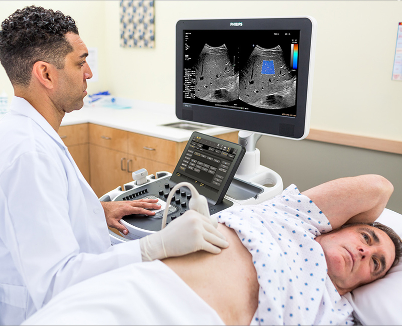 Эластография печени. Фото ICE Magazine | Фиброскан или эластография печени Эластография печени. Фото ICE Magazine | Фиброскан или эластография печени