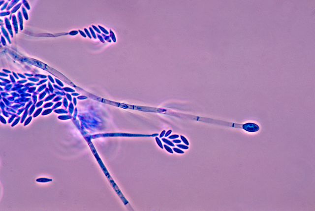 Fusarium verticillioides под микроскопом by CDC / Dr. Libero Ajello (PHIL# 4011), 1978. | Фузариоз человека Fusarium verticillioides под микроскопом by CDC / Dr. Libero Ajello (PHIL# 4011), 1978. | Фузариоз человека